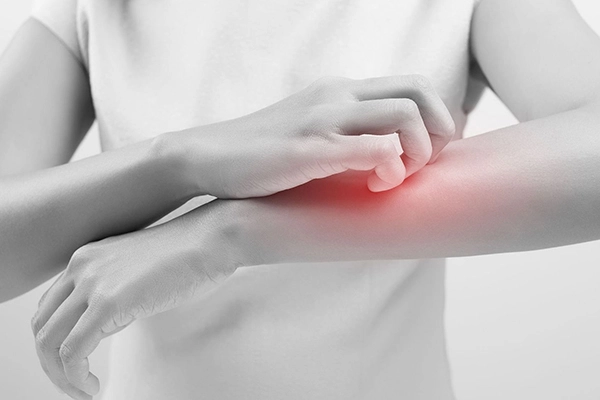 Postherpetic Neuralgia Pain Treatment