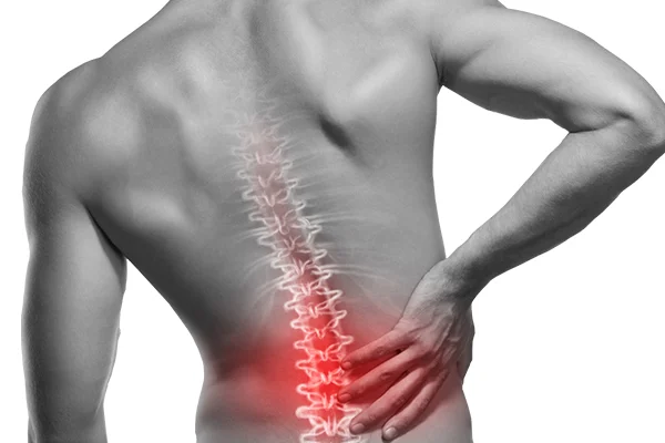 Sciatica Pain Treatment